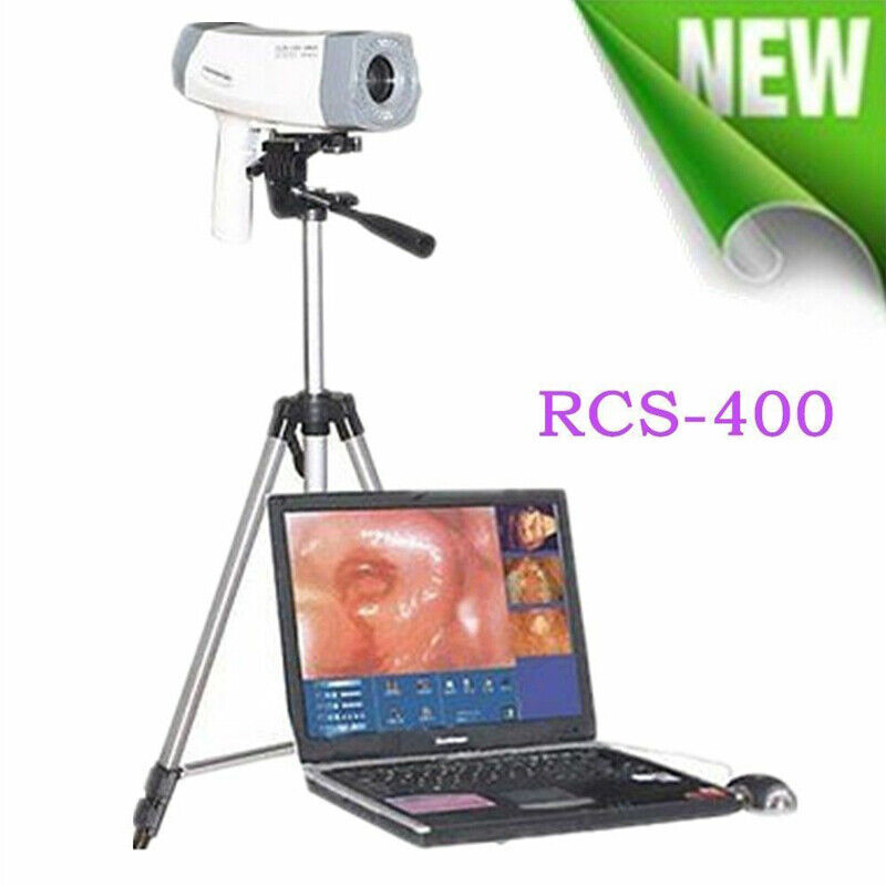 Color Electronic Video Vaginoscopy Colposcope Imaging Tripod& Software A+